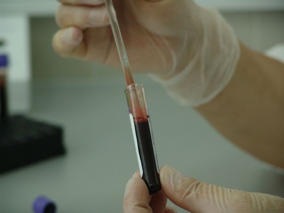 Vegan Blood Tests for Health, Vegan Medical Test, Vegan Medical Checkup